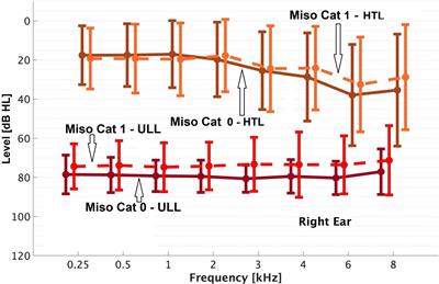 Audiological and Other Factors Predicting the Presence of Misophonia Symptoms Among a Clinical Population Seeking Help for Tinnitus and/or Hyperacusis